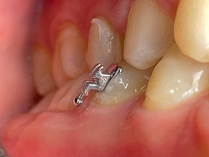 Fully adjustable light kit