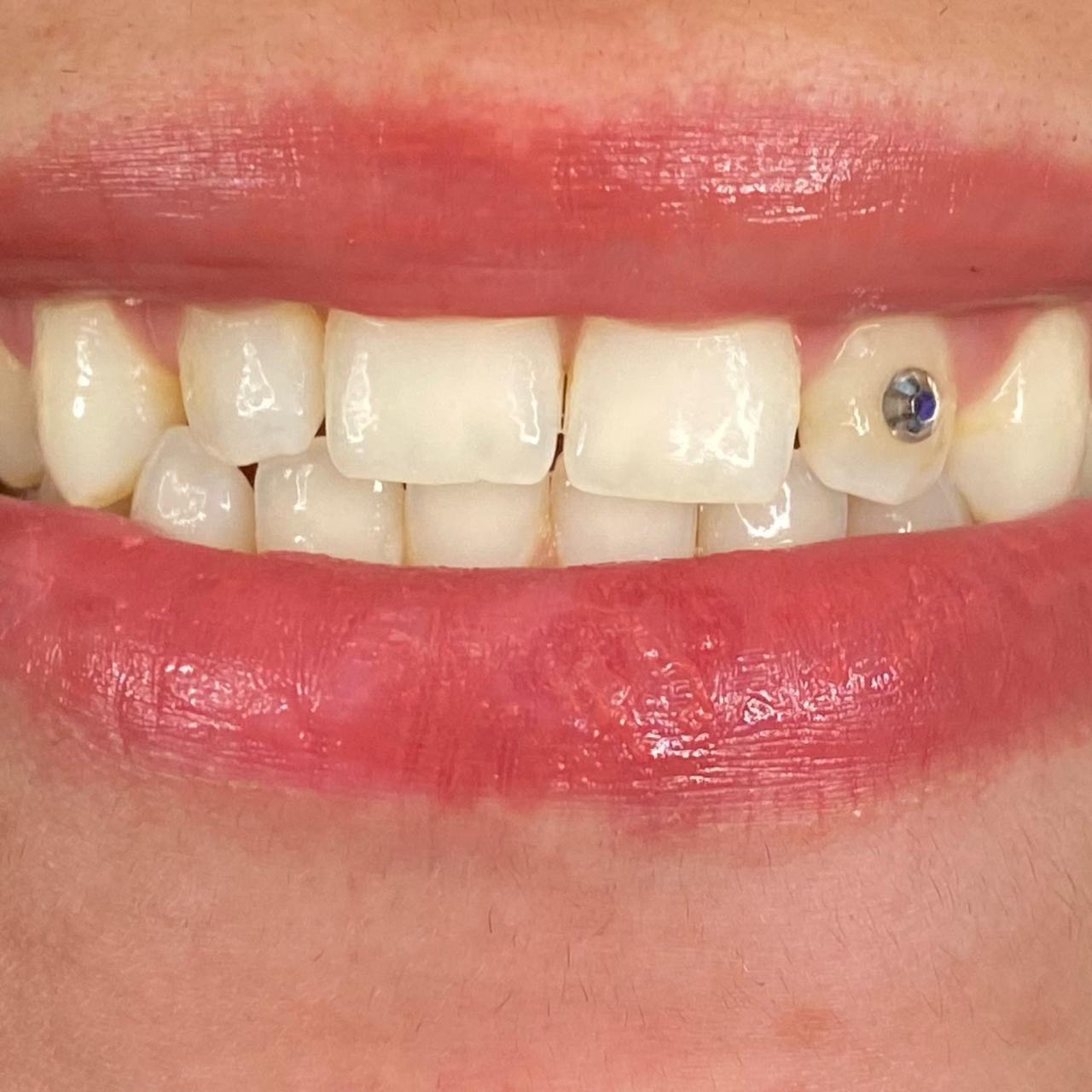 Fully adjustable light kit