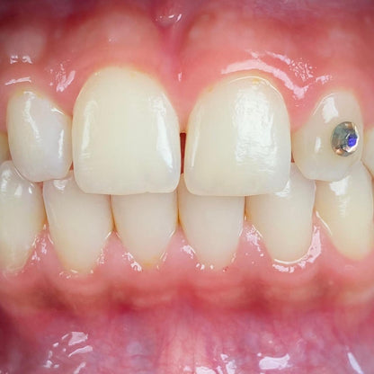 Fully adjustable light kit