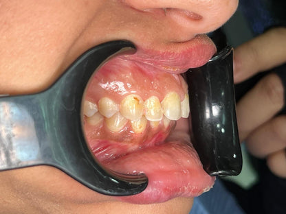 Fully adjustable light kit